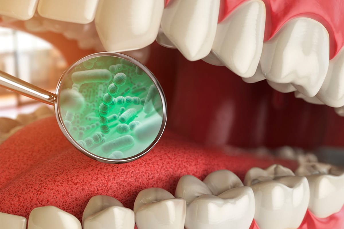 Bacterias en la Boca