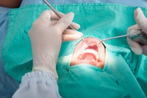 Cirugía Oral en Linares