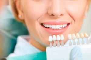 Estética Dental en Linares