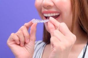 Ortodoncia Invisible en Linares