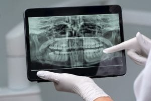 Radiografía Dental en Linares