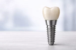 implantes dentales en linares