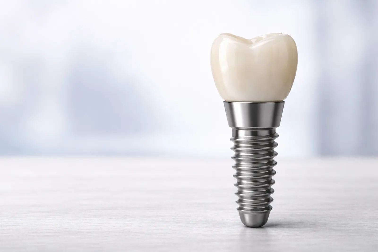 implantes dentales en linares